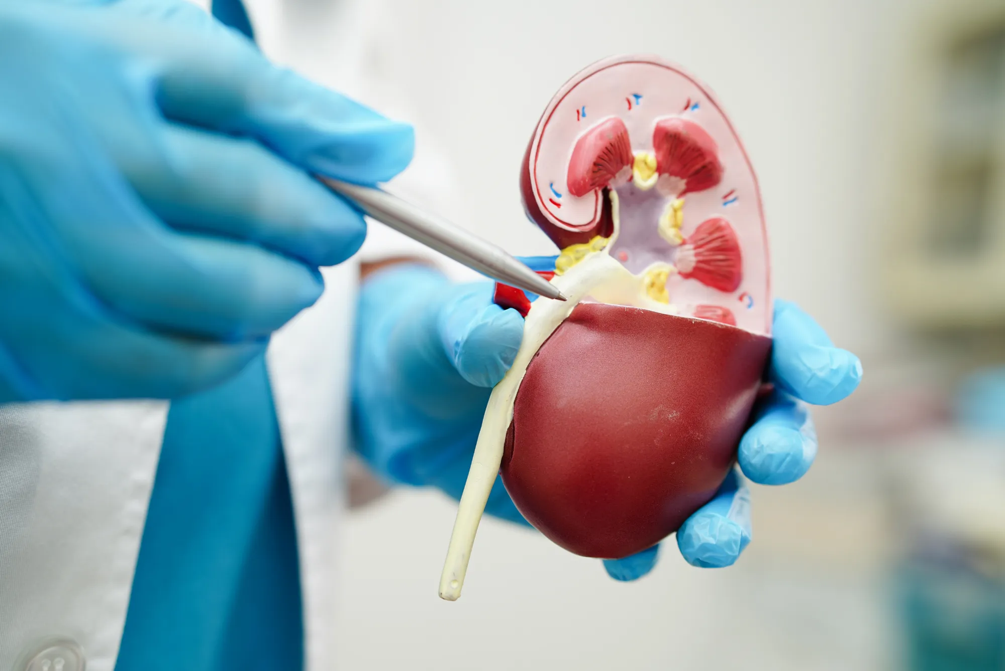 Organ Transplant From Donor to Recipient
